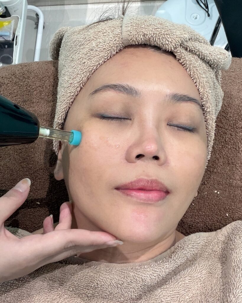 Shalab needle-free facial treatment using air pressure technology at Melange Korea