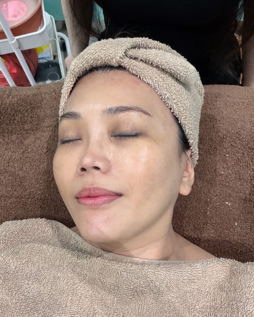 Glowing skin after facial treatment at Melange Korea Gardens Mall with smooth and hydrated complexion